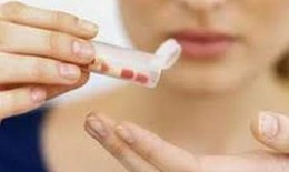Tuân thủ dùng thuốc ở người loạn thần nặng