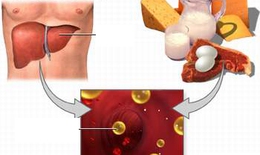 Các “chiêu” tăng hiệu quả thuốc hạ mỡ máu