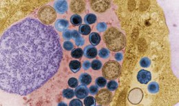 Bệnh lậu, chlamydia và thuốc trị