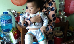 Đón con ở nhà trẻ về thấy gãy cả 2 chân