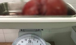Thương con, người mẹ nén đau "ôm" khối u xơ 5kg