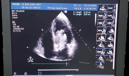 Xuyên đêm cứu sống bệnh nhân u tim