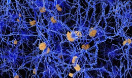 Phân tử diệt mảng Alzheimer ở chuột