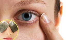 5 mẹo hay giúp giảm thâm quầng mắt