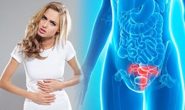 7 dấu hiệu cảnh báo ung thư buồng trứng