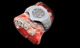Máy quét công nghệ mới cho hình ảnh Xquang màu 3D đầu tiên trên thế giới