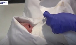 Em bé ở Czech sinh ra từ người mẹ chết não 117 ngày