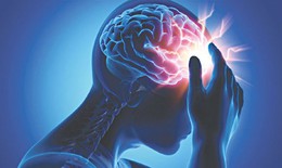 Nguy cơ đột quỵ cao nếu như chủ quan với thiếu máu não thoảng qua