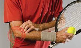 Hội chứng khuỷu tay quần vợt - Khi nào cần đi khám ?