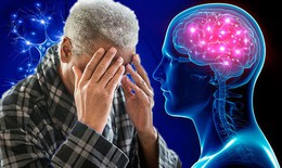 Alzheimer làm tăng nguy cơ mắc COVID-19 nghiêm trọng và tử vong