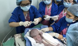 Thai nhi suýt tử vong do khối u quái chèn ép đường thở