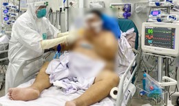 Hai bệnh nhân COVID-19 nặng đã hồi phục