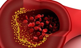 Dùng niacin trị rối loạn mỡ máu: Các tác dụng phụ cần lưu ý