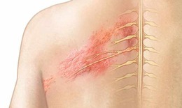 Kinh nghiệm chữa bệnh ngoài da từ sung