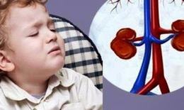 Những điều cần biết về hội chứng thận hư ở trẻ em