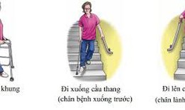 Tập phục hồi chức năng sau mổ thay khớp gối