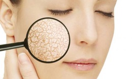 Khắc phục da khô khi trời hanh