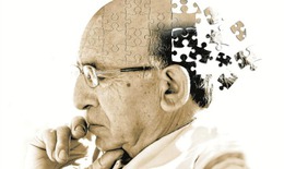 Có thuốc chữa khỏi bệnh mất trí nhớ?