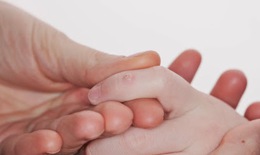 Ðiều trị mụn cóc thế nào?