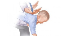 Câu chuyện hóc dị vật ở trẻ nhỏ