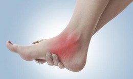 Bong gân khớp cổ chân và cách xử trí