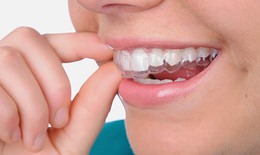 Trị chứng nghiến răng ở trẻ