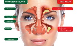 Các thuốc điều trị viêm mũi xoang