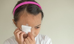 Sơ cứu bỏng mắt do hóa chất ở trẻ em