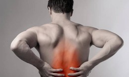 Cảnh báo: U tủy dễ nhầm với thoái hóa cột sống