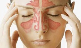 Tự trị bệnh mũi xoang, bệnh thêm nặng