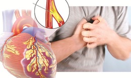 Bất thường động mạch vành có thể gây đột tử