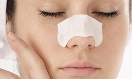 Viêm da tiết bã nhờn: Dễ tiến triển nặng, dai dẳng