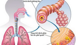 Một số bài thuốc trị viêm đường hô hấp trên