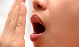 Hôi miệng vì sao?