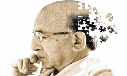 Bệnh Alzheimer có phải do di truyền?