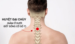 Trị liệu say nắng, say nóng