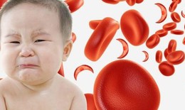 Làm gì khi trẻ thiếu máu thiếu sắt?