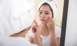 Dị ứng mỹ phẩm, chớ xem thường!
