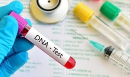 Xét nghiệm DNA mở đường cho việc chăm sóc da tương lai