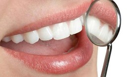 Chảy máu chân răng có đáng lo?