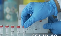Tìm kiếm thuốc điều trị COVID-19: Có thể tái sử dụng các loại thuốc cũ?