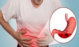 Vitamin C tăng cường miễn dịch, quá liều sẽ gây hại