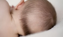 Rụng tóc ở trẻ nhỏ có phải do còi xương?