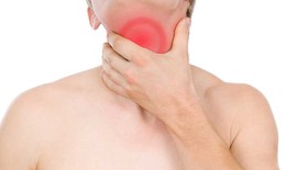 Viêm đường hô hấp do trào ngược dạ dày thực quản?