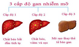 Ứng phó với chứng gan nhiễm mỡ không do rượu