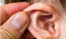 Bé mắc viêm tai giữa, coi chừng bị giảm thính lực