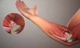 Đau khớp khuỷu tay: Nguyên nhân và cách xử trí