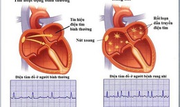 Nhiều đột phá trong ứng dụng điều trị các bệnh tim mạch