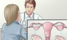Đừng nghĩ u nang buồng trứng không nguy hiểm