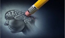 Alzheimer - hiểu để cảm thông